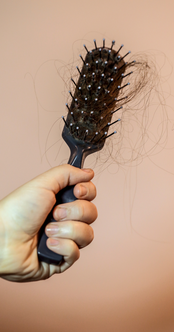 brosse-pleine-de-cheveux brosse-pleine-de-cheveux