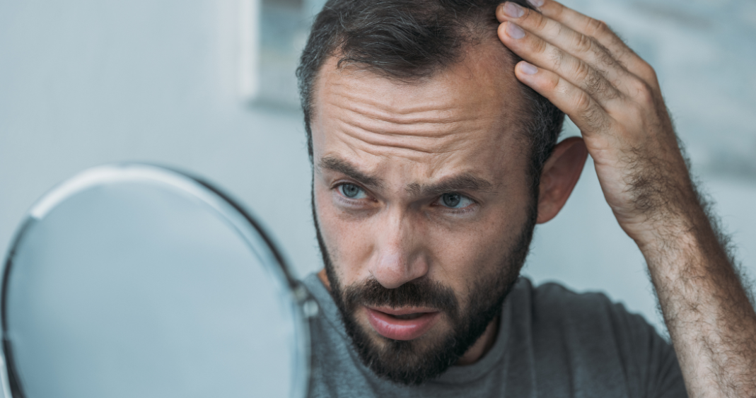 homme-qui-se-touche-les-cheveux homme-qui-se-touche-les-cheveux