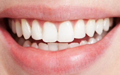 L&rsquo;accès aux soins dentaires : entre problèmes médicaux et sociaux