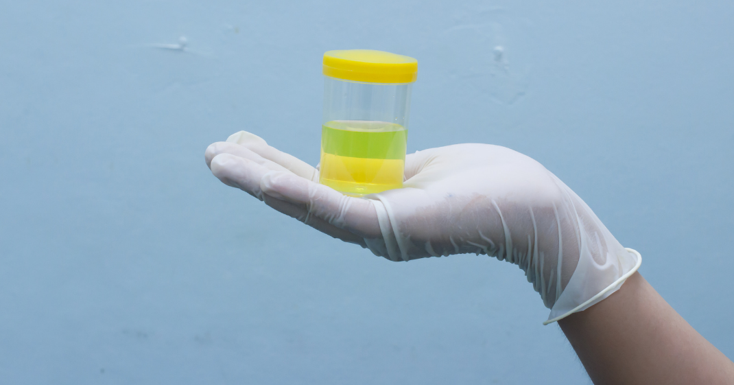pot-urine pot-urine