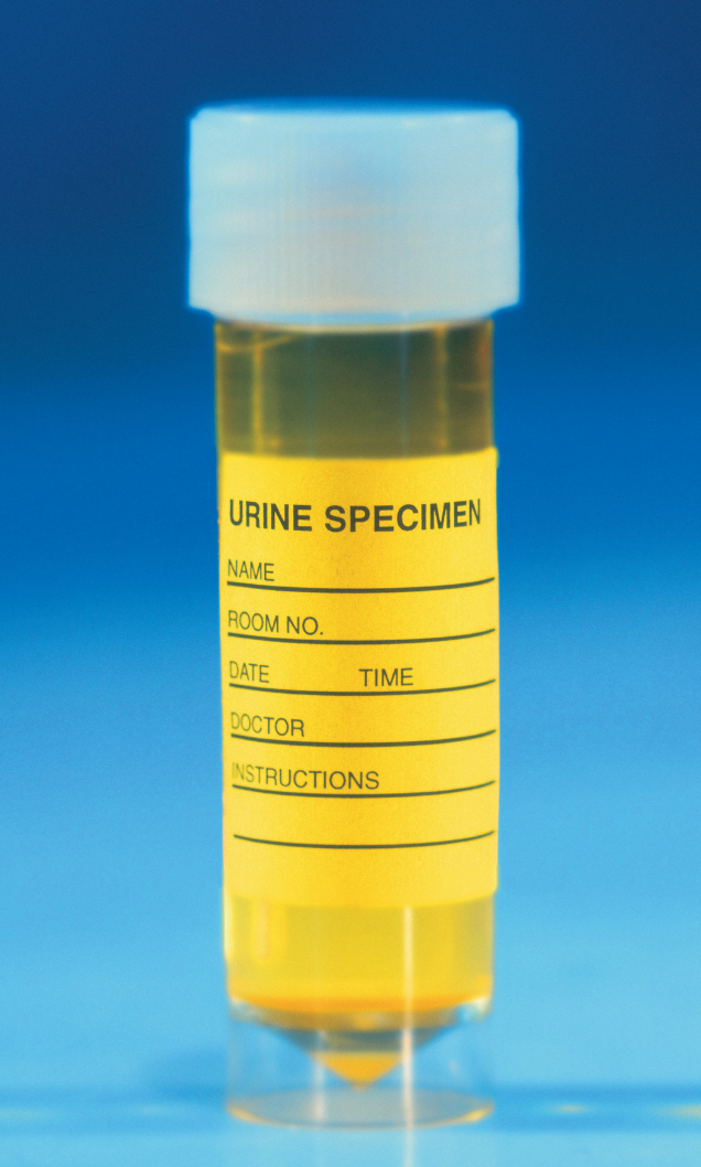 flacon-urine flacon-urine
