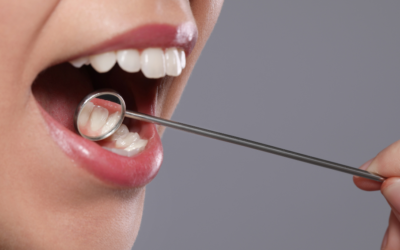 Le Cancer de la Gencive: Une Menace Silencieuse à Surveiller