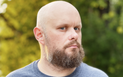 Les Dangers Cachés des Traitements Contre la Calvitie