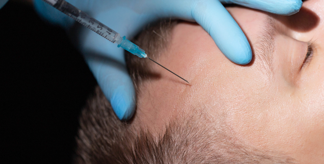 injection-cheveux injection-cheveux