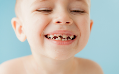 Lien Entre Boissons Sucrées et Caries Dentaires : Impact et Prévention