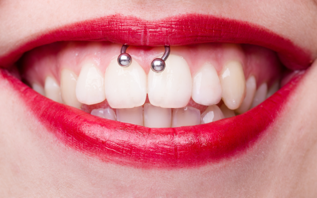 Les Risques Méconnus du Piercing Smiley sur la Santé Bucco-Dentaire