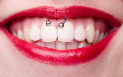 Les Risques Méconnus du Piercing Smiley sur la Santé Bucco-Dentaire