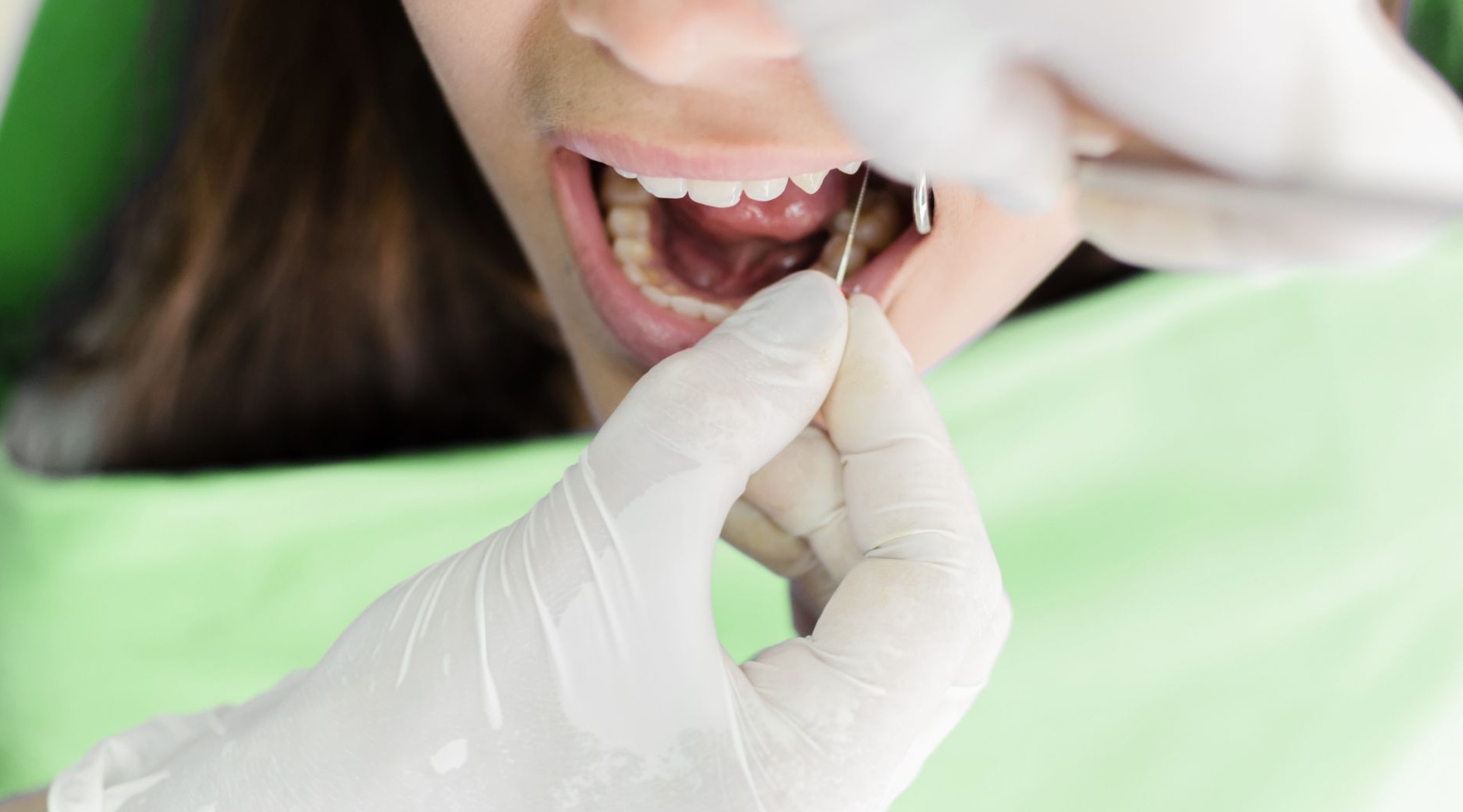 devitalisation-dentaire